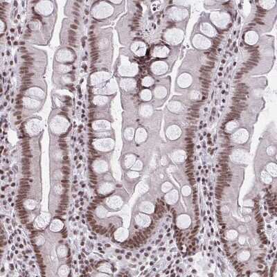 Immunohistochemistry-Paraffin: CTCF Antibody (CL0304) [NBP2-52909]