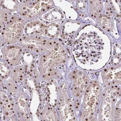 Immunohistochemistry-Paraffin: CTCF Antibody (CL0305) [NBP2-52910]