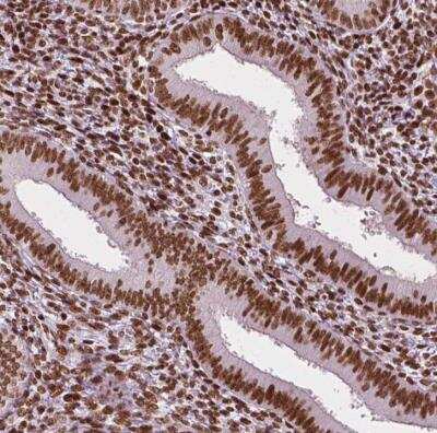Immunohistochemistry-Paraffin: CTCF Antibody (CL0307) [NBP2-52911]