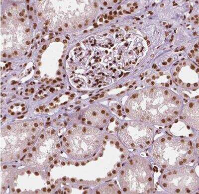 Immunohistochemistry-Paraffin: CTCF Antibody (CL0307) [NBP2-52911]