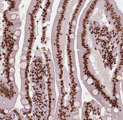 Immunohistochemistry-Paraffin: CTCF Antibody (CL0307) [NBP2-52911]