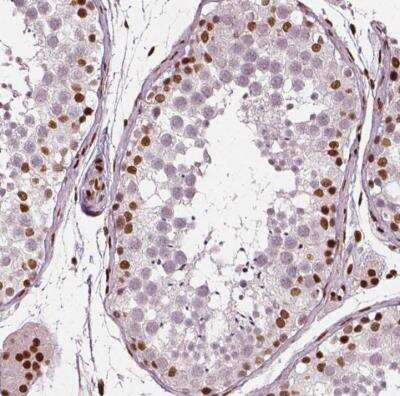 Immunohistochemistry-Paraffin: CTCF Antibody (CL0307) [NBP2-52911]
