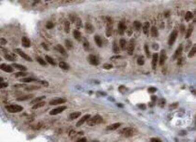 Immunohistochemistry-Paraffin: CTCF Antibody (CL0307) [NBP2-52911]