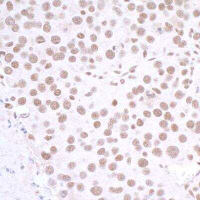 Immunohistochemistry-Paraffin: CTCF Antibody [NB500-177]