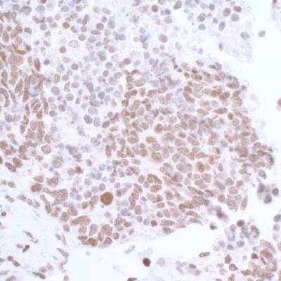 Immunohistochemistry-Paraffin: CTCF Antibody [NB500-177]