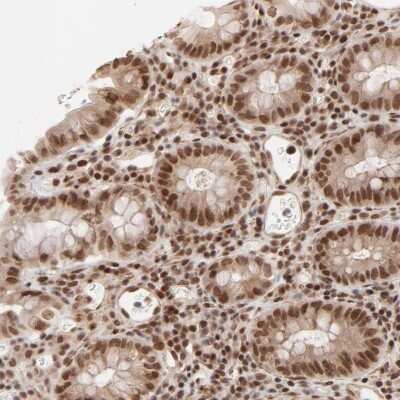 Immunohistochemistry: CTCF Antibody [NBP2-33854]