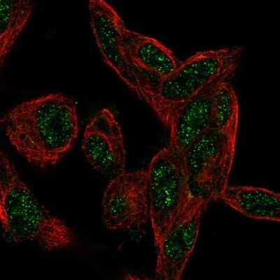 Immunocytochemistry/ Immunofluorescence: CTDSP1 Antibody [NBP2-57578]