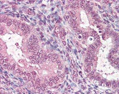 Immunohistochemistry-Paraffin: CTDSP1 Antibody [NBP1-06029]