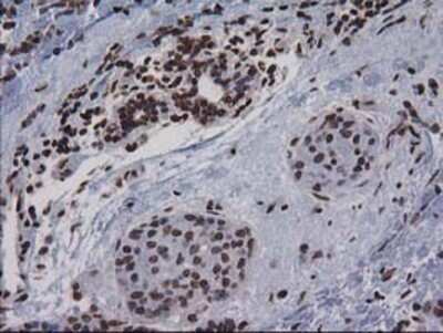 Immunohistochemistry: CTDSP1 Antibody (OTI1B6) - Azide and BSA Free [NBP2-72110]