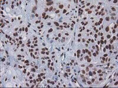Immunohistochemistry: CTDSP1 Antibody (OTI1B6) - Azide and BSA Free [NBP2-72110]