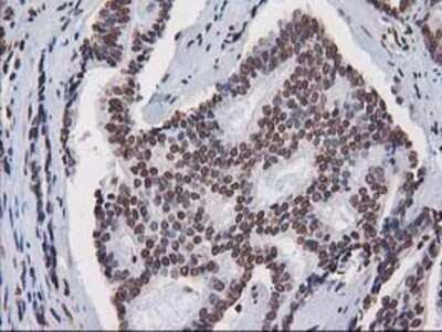 Immunohistochemistry: CTDSP1 Antibody (OTI1B6) - Azide and BSA Free [NBP2-72110]