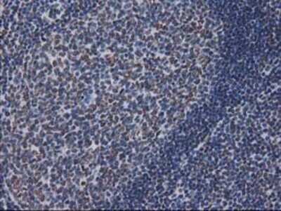 Immunohistochemistry: CTDSP1 Antibody (OTI1B6) - Azide and BSA Free [NBP2-72110]