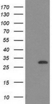 Western Blot: CTDSP1 Antibody (OTI1B6)Azide and BSA Free [NBP2-72110]