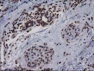 Immunohistochemistry-Paraffin: CTDSP1 Antibody (OTI1B6) [NBP2-03456]