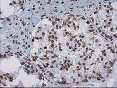Immunohistochemistry-Paraffin: CTDSP1 Antibody (OTI1B6) [NBP2-03456]