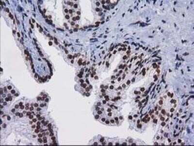 Immunohistochemistry-Paraffin: CTDSP1 Antibody (OTI1B6) [NBP2-03456]