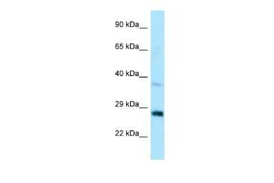 Western Blot: CTDSP1 Antibody [NBP2-87226]