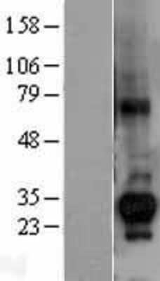 Western Blot: CTDSP1 Overexpression Lysate [NBL1-09566]