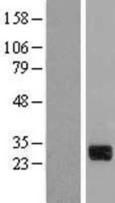 Western Blot: CTDSP1 Overexpression Lysate [NBL1-09567]