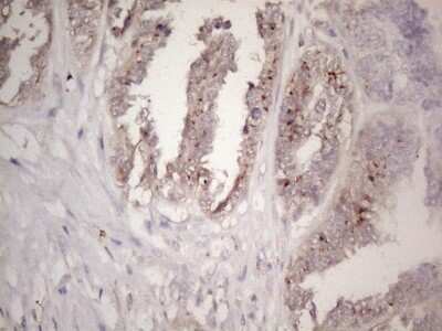 Immunohistochemistry: CTDSP2 Antibody (OTI7F5) [NBP2-46391]