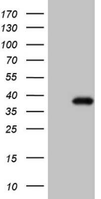 Western Blot: CTDSP2 Antibody (OTI7F5) [NBP2-46391]