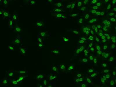 Immunocytochemistry/ Immunofluorescence: CTDSP2 Antibody [NBP2-97362]