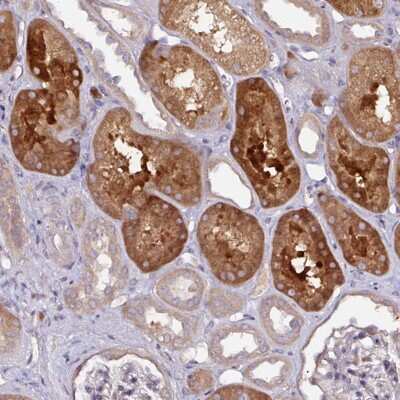 Immunohistochemistry: CTDSP2 Antibody [NBP2-49053]