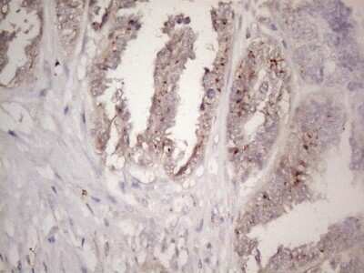 Immunohistochemistry: CTDSP2 Antibody (OTI7F5) - Azide and BSA Free [NBP2-71552]