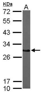 Western Blot: CTDSP2 Antibody [NBP1-32283]
