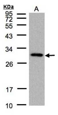 Western Blot: CTDSP2 Antibody [NBP1-32283]