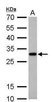 Western Blot: CTDSP2 Antibody [NBP1-32283]