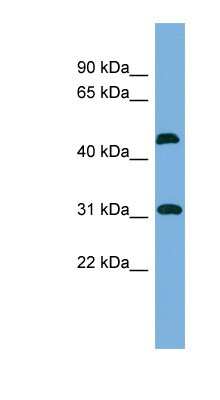 Western Blot: CTDSP2 Antibody [NBP1-55471]