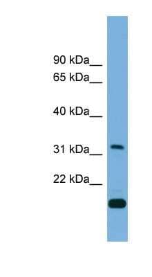 Western Blot: CTDSP2 Antibody [NBP1-56566]