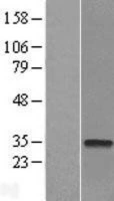 Western Blot: CTDSP2 Overexpression Lysate [NBL1-09568]