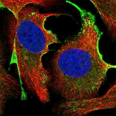 Immunocytochemistry/ Immunofluorescence: CTDSPL Antibody [NBP2-31913]