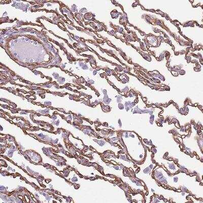 Immunohistochemistry-Paraffin: CTDSPL Antibody [NBP2-31913]