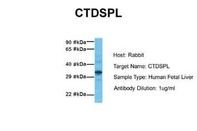 Western Blot: CTDSPL Antibody [NBP1-53169]