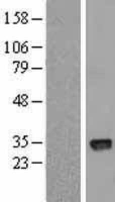 Western Blot: CTDSPL Overexpression Lysate [NBL1-09569]