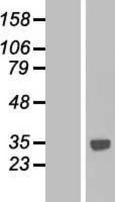 Western Blot: CTDSPL Overexpression Lysate [NBP2-08808]