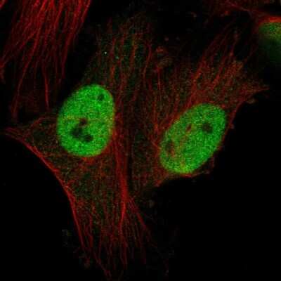 Immunocytochemistry/ Immunofluorescence: CTDSPL2 Antibody [NBP2-56941]