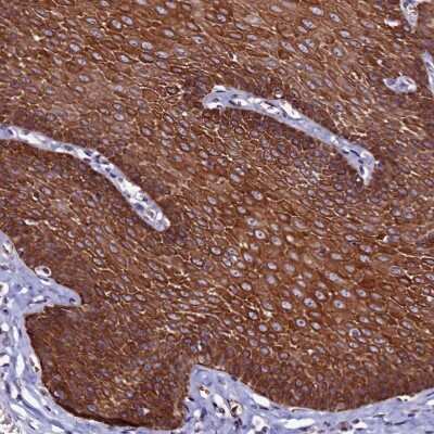 Immunohistochemistry-Paraffin: CTDSPL2 Antibody [NBP1-91814]