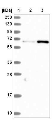 Western Blot: CTDSPL2 Antibody [NBP1-91814]