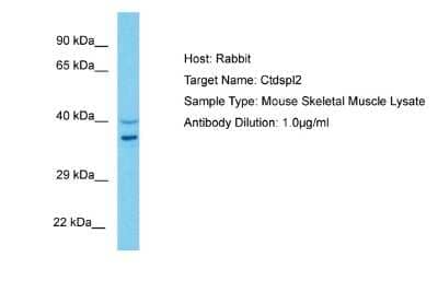 Western Blot: CTDSPL2 Antibody [NBP2-84730]