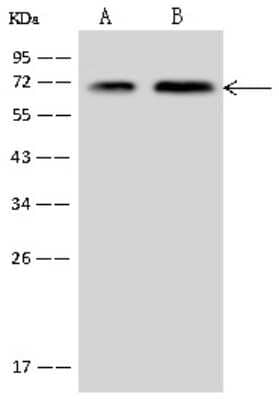 Western Blot: CTDSPL2 Antibody [NBP2-97397]