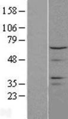 Western Blot: CTDSPL2 Overexpression Lysate [NBL1-09570]