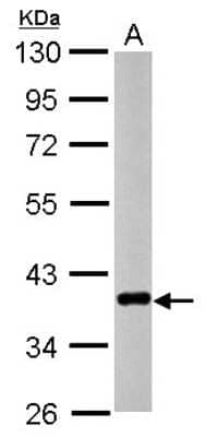 Western Blot: CTGF/CCN2 Antibody [NBP2-16026]