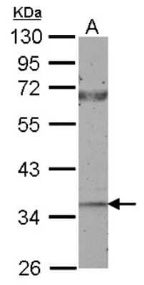 Western Blot: CTGF/CCN2 Antibody [NBP2-16026]