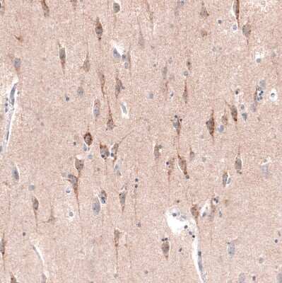 Immunohistochemistry-Paraffin: CTGF/CCN2 Antibody (CL5339) [NBP2-61415]