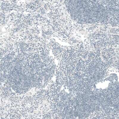 Immunohistochemistry-Paraffin: CTGF/CCN2 Antibody (CL5339) [NBP2-61415]