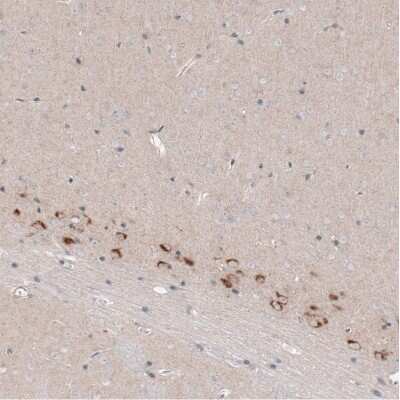 Immunohistochemistry-Paraffin: CTGF/CCN2 Antibody (CL5339) [NBP2-61415]